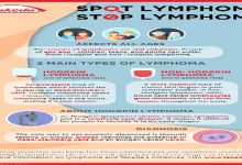 Takeda - Spot Lymphoma, Stop Lymphoma Infographic